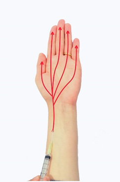 モヤモヤ血管とは